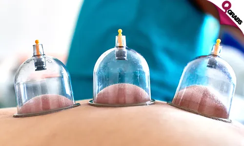 Ladies' Cupping Treatments: Gliding, Facial Massage, & Hijama at Al Hadi Medical!